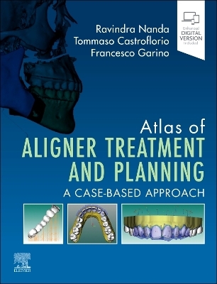 Atlas of Aligner Treatment and Planning - 