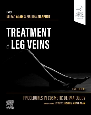 Procedures in Cosmetic Dermatology Series: Treatment of Leg Veins