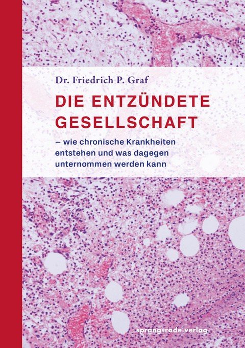 Die entz&uuml;ndete Gesellschaft - Friedrich P. Graf