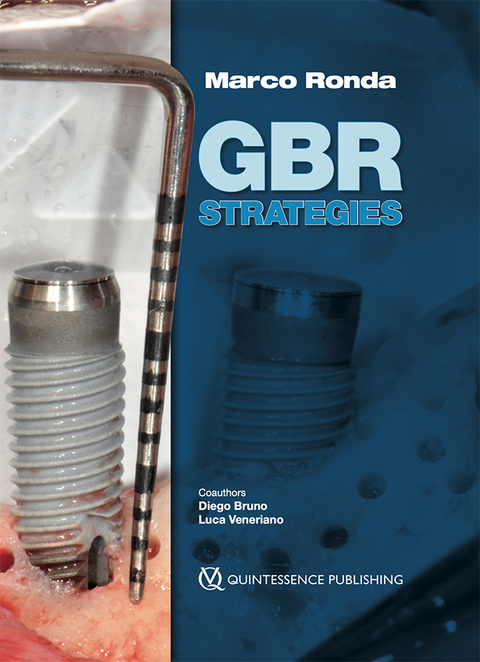 GBR Strategies - Marco Ronda