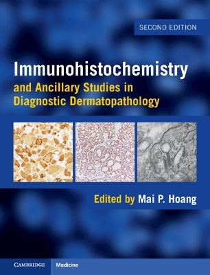 Immunohistochemistry and Ancillary Studies in Diagnostic Dermatopathology - 