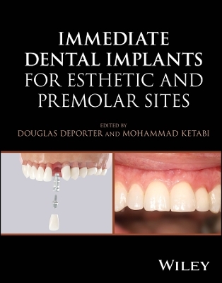 Immediate Dental Implants for Esthetic and Premolar Sites - 
