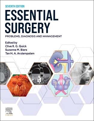Essential Surgery - 