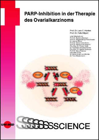 PARP-Inhibition in der Therapie des Ovarialkarzinoms