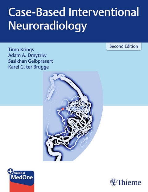 Case-Based Interventional Neuroradiology - Timo Krings, Adam Dmytriw, Sasikhan Geibprasert, Karel ter Brugge