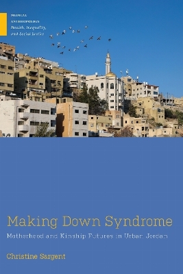 Making Down Syndrome - Christine Sargent