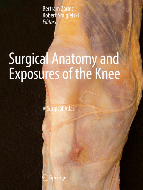 Surgical Anatomy and Exposures of the Knee - 