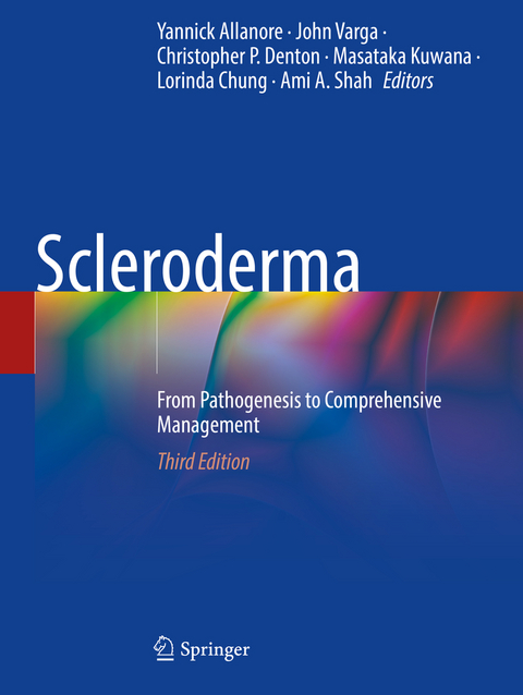 Scleroderma - 