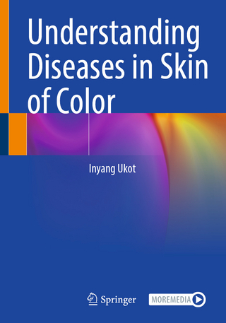 Understanding Diseases in Skin of Color