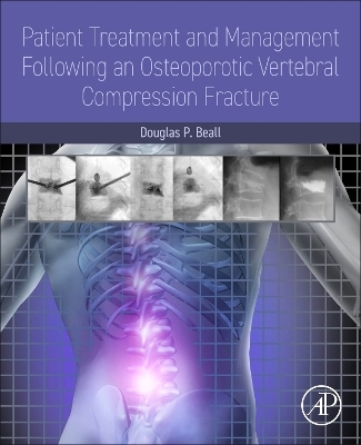 Patient Treatment and Management Following an Osteoporotic Vertebral Compression Fracture - Douglas P. Beall