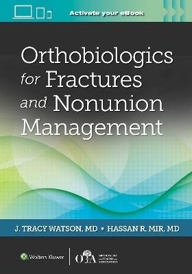 Orthobiologics for Fractures and Nonunion Management - 