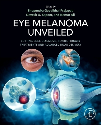 Eye Melanoma Unveiled - 