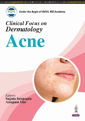 Clinical Focus on Dermatology: Acne