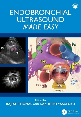 Endobronchial Ultrasound Made Easy - 