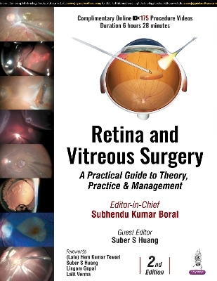 Retina and Vitreous Surgery - Subhendu Kumar Boral, Suber S Huang