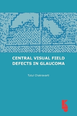 Central Visual Field Defects in Glaucoma
