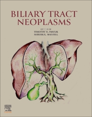 Biliary Tract Neoplasms