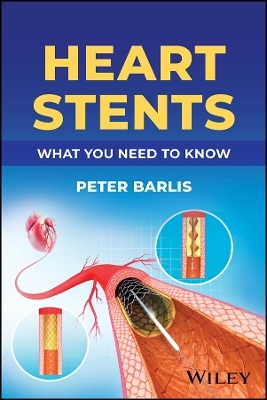 Heart Stents - Peter Barlis