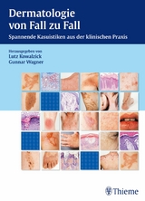 Dermatologie von Fall zu Fall -  Lutz Kowalzick,  Gunnar Wagner