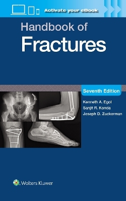 Handbook of Fractures: Print + eBook with Multimedia - Kenneth A. Egol