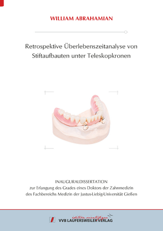 Retrospektive Überlebenszeitanalyse von Stiftaufbauten unter Teleskopkronen
