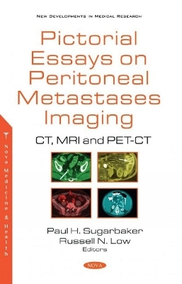 Pictorial Essays on Peritoneal Metastases Imaging