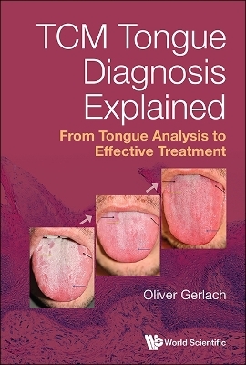 Tcm Tongue Diagnosis Explained: From Tongue Analysis To Effective Treatment - Oliver Gerlach