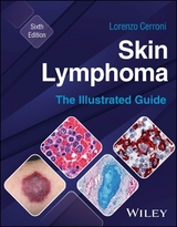 Skin Lymphoma - Cerroni, Lorenzo