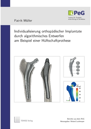 Individualisierung orthopädischer Implantate durch algorithmisches Entwerfen am Beispiel einer Hüftschaftprothese