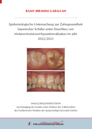 Epidemiologische Untersuchung zur Zahngesundheit bayerischer Schüler unter Einschluss von Molaren-Inzisiven-Hypomineralisation im Jahr 2022/2023