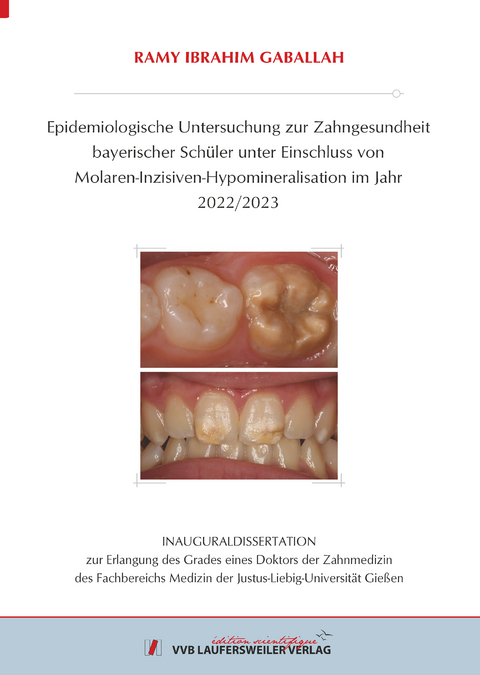 Epidemiologische Untersuchung zur Zahngesundheit bayerischer Sch&uuml;ler unter Einschluss von Molaren-Inzisiven-Hypomineralisation im Jahr 2022/2023 - Ramy Ibrahim Gaballah
