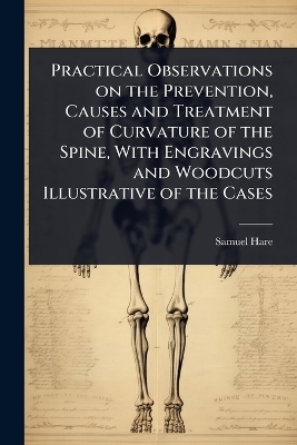 Practical Observations on the Prevention, Causes and Treatment of Curvature of the Spine, With Engravings and Woodcuts Illustrative of the Cases