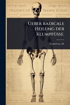 Ueber radicale Heilung der Klumpf&Atilde;1/4sse. - 