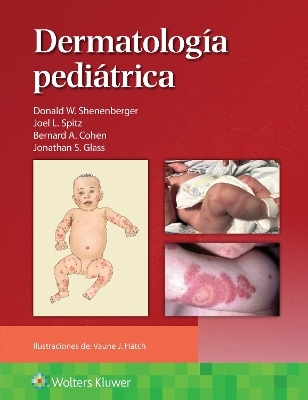 Dermatolog&iacute;a pedi&aacute;trica - Donald William Shenenberger, Joel L. Spitz