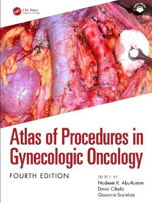 Atlas of Procedures in Gynecologic Oncology - 