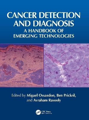 Cancer Detection and Diagnosis - 