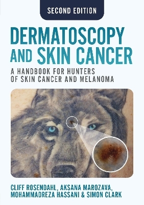 Dermatoscopy and Skin Cancer, second edition - Cliff Rosendahl, Aksana Marozava, Mohammadreza Hassani, Simon Clark