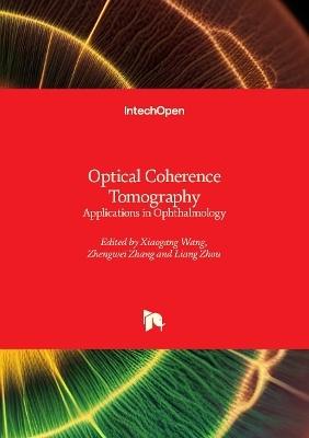 Optical Coherence Tomography - 