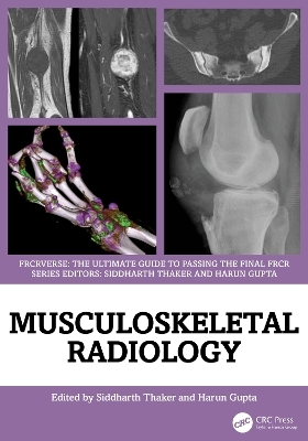 Musculoskeletal Radiology - 