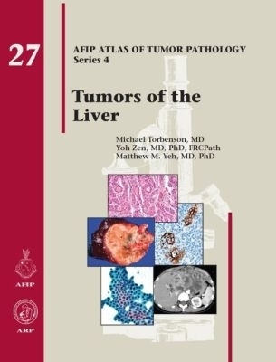 Tumors of the Liver - Michael Torbenson, Yoh Zen, Matthew M. Yeh