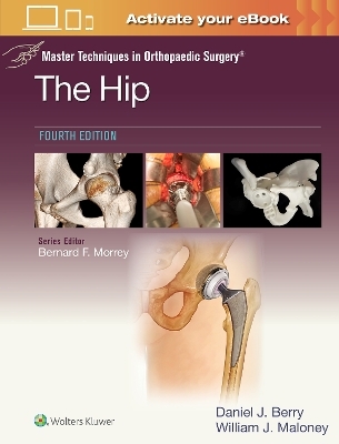 Master Techniques in Orthopaedic Surgery: The Hip: Print + eBook with Multimedia - DANIEL JOHN BERRY, WILLIAM JOSEPH MALONEY