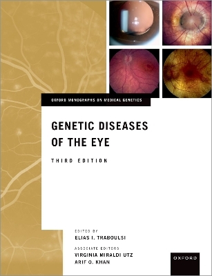 Genetic Diseases of the Eye