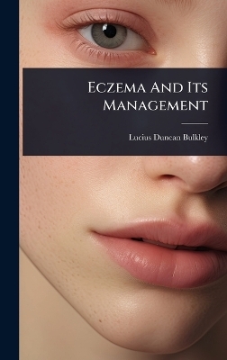 Eczema And Its Management