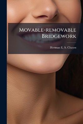 Movable-removable Bridgework