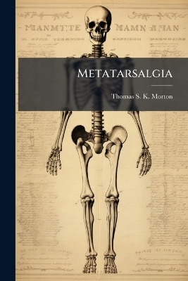 Metatarsalgia - 