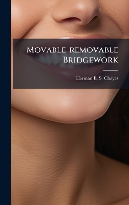 Movable-removable Bridgework - 