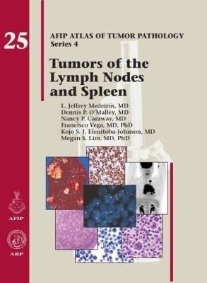 Tumors of the Lymph Nodes and Spleen - L. Jeffrey Medeiros, Dennis P. O'Malley, Nancy P. Caraway, Francisco Vega, Kojo S. J. Elenitoba-Johnson