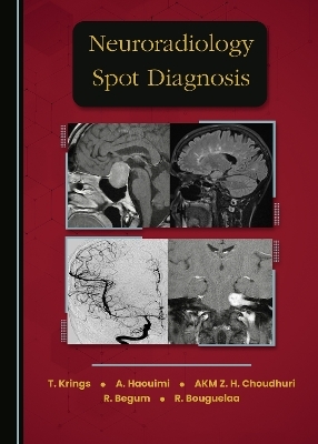 Neuroradiology Spot Diagnosis