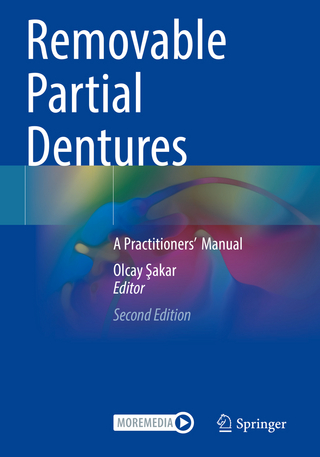 Removable Partial Dentures