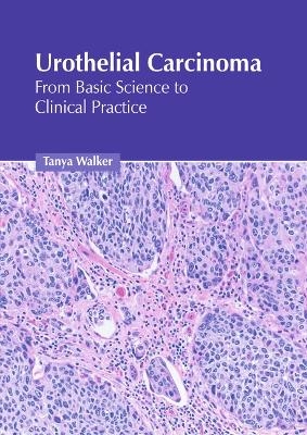 Urothelial Carcinoma: From Basic Science to Clinical Practice - 